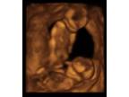 Business For Sale: Baby Ultrasound Business - Opportunity