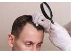 Explore our 8000 Grafts Hair Transplant Results Today