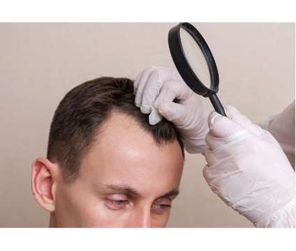 Explore our 8000 Grafts Hair Transplant Results Today is a Medical Care service in London LND