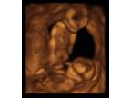 Business For Sale: Baby Ultrasound Business