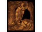 Business For Sale: Baby Ultrasound Business